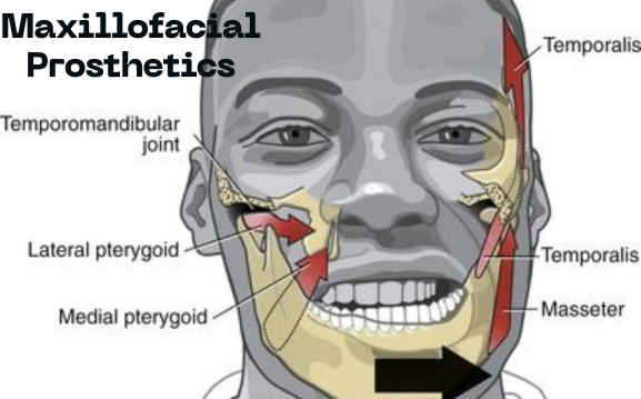 An image as Maxillofacial Prosthetics: Reestablishing Shape & Function